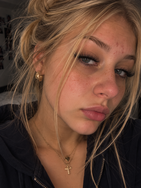 Chloé A.